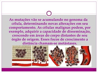 As mutações vão se acumulando no genoma da
célula, determinando novas alterações em seu
comportamento. As células malignas podem, por
exemplo, adquirir a capacidade de disseminação,
crescendo em áreas do corpo distantes de seu
órgão de origem. Esses focos de crescimento a
distância chamam-se metástases.
)
 