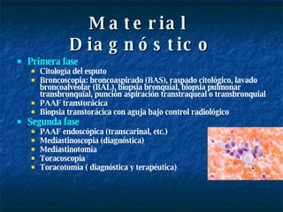 Material  Diagnóstico Primera fase Citología del esputo Broncoscopia: broncoaspirado (BAS), raspado citológico, lavado broncoalveolar (BAL), biopsia bronquial, biopsia pulmonar transbronquial, punción aspiración transtraqueal o transbronquial PAAF transtorácica Biopsia transtorácica con aguja bajo control radiológico Segunda fase PAAF endoscópica (transcarinal, etc.) Mediastinoscopia (diagnóstica) Mediastinotomía Toracoscopia Toracotomía ( diagnóstica y terapéutica) 