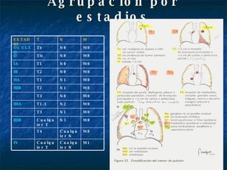 Agrupación por estadios M1 Cualquier N Cualquier T IV M0 Cualquier N T4 M0 N3 Cualquier T IIIB M0 N1 T3 M0 N2 T1-3 IIIA M0 N0 T3 M0 N1 T2 IIIB M0 N1 T1 IIA M0 N0 T2 IB M0 N0 T1 IA M0 N0 Tis O M0 N0 Tx OCULTO M N T ESTADIO 
