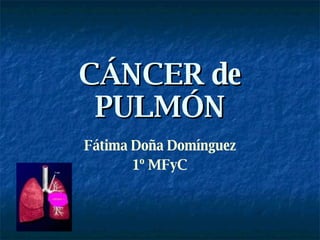CÁNCER de PULMÓN Fátima Doña Domínguez 1º MFyC 