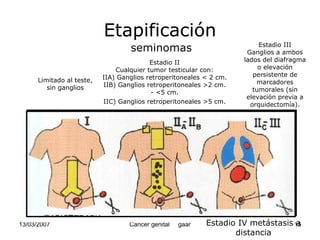 Cáncer Genital