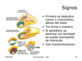 Cáncer Genital