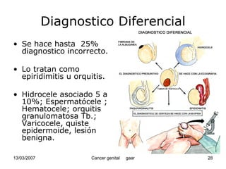 Cáncer Genital