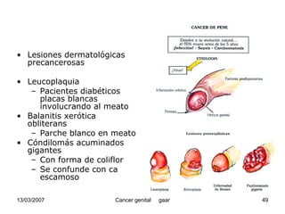 Cáncer Genital