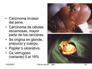 Cáncer Genital