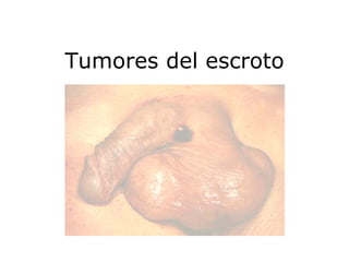 Cáncer Genital