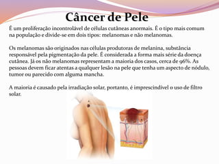 É um proliferação incontrolável de células cutâneas anormais. É o tipo mais comum
na população e divide-se em dois tipos: melanomas e não melanomas.
Os melanomas são originados nas células produtoras de melanina, substância
responsável pela pigmentação da pele. É considerada a forma mais série da doença
cutânea. Já os não melanomas representam a maioria dos casos, cerca de 96%. As
pessoas devem ficar atentas a qualquer lesão na pele que tenha um aspecto de nódulo,
tumor ou parecido com alguma mancha.
A maioria é causado pela irradiação solar, portanto, é imprescindível o uso de filtro
solar.
Câncer de Pele
 