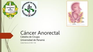 Cáncer Anorectal
Cátedra de Cirugía
Universidad de Panamá
Caleb Ramos 8-943-158
 