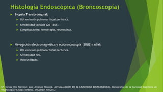 Histología Endoscópica (Broncoscopía)
 Biopsia Transbronquial:
 Útil en lesión pulmonar focal periférica.
 Sensibilidad variable (20 – 85%).
 Complicaciones: hemorragia, neumotórax.
 Navegación electromagnética y ecobroncoscopía (EBUS) radial:
 Útil en lesión pulmonar focal periférica.
 Sensibilidad 70%.
 Poco utilizado.
Mª Teresa Río Ramírez, Luis Jiménez Hiscock. ACTUALIZACIÓN EN EL CARCINOMA BRONCOGÉNICO. Monografías de la Sociedad Madrileña de
Neumología y Cirugía Torácica. VOLUMEN XIX/2012
 