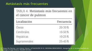 Metástasis más frecuentes
Mª Teresa Río Ramírez, Luis Jiménez Hiscock. ACTUALIZACIÓN EN EL CARCINOMA BRONCOGÉNICO. Monografías de la Sociedad Madrileña de
Neumología y Cirugía Torácica. VOLUMEN XIX/2012
 