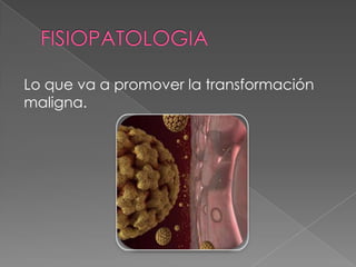 Lo que va a promover la transformación
maligna.
 