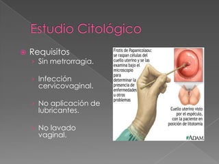    Requisitos
    › Sin metrorragia.

    › Infección
      cervicovaginal.

    › No aplicación de
      lubricantes.

    › No lavado
      vaginal.
 