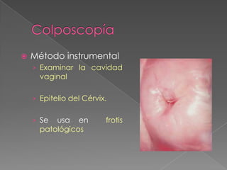    Método instrumental
    › Examinar la cavidad
      vaginal

    › Epitelio del Cérvix.


    › Se  usa en         frotis
      patológicos
 