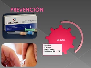 PREVENCIÓN




                                Vacuna

             • Gardasil
             • Cervarix
             • 3 en 6 meses
             • Subtipos 6, 11, 16, 18
 