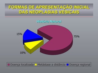FORMAS DE APRESENTAÇÃO INICIAL DAS NEOPLASIAS VESICAIS História Natural 