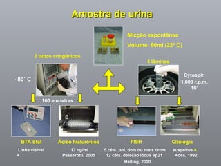 Amostra de urina 2 tubos criogênicos 4 lâminas - 80˚ C 160 amostras Micção espontânea Volume: 60ml (22 º C)  BTA Stat  Ácido hialurônico  FISH  Citologia Linha visível  13 ng/ml  5 céls. pol. dois ou mais crom.  suspeitos  =  +   Passerotti, 2005  12 céls. deleção lócus 9p21  Koss, 1992    Halling, 2000  Cytospin 1.000 r.p.m. 10 ’ 