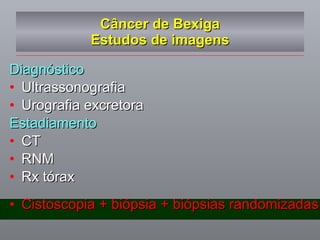 Câncer de Bexiga Estudos de imagens Diagnóstico Ultrassonografia Urografia excretora Estadiamento CT RNM Rx tórax  Cistoscopia + biópsia + biópsias randomizadas 