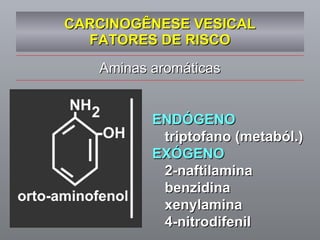 CARCINOGÊNESE VESICAL FATORES DE RISCO ENDÓGENO triptofano (metaból.) EXÓGENO 2-naftilamina benzidina xenylamina 4-nitrodifenil Aminas aromáticas 