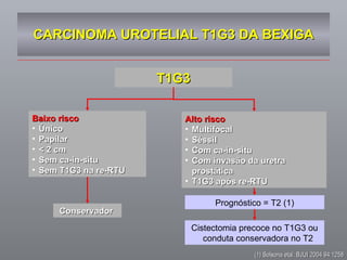CARCINOMA UROTELIAL T1G3 DA BEXIGA (1) Solsona etal. BJUI 2004 94:1258 Baixo risco Único Papilar < 2 cm Sem ca-in-situ Sem T1G3 na re-RTU Alto risco Multifocal Séssil Com ca-in-situ Com invasão da uretra prostática T1G3 após re-RTU T1G3 Conservador  Cistectomia precoce no T1G3 ou conduta conservadora no T2 Prognóstico = T2 (1) 
