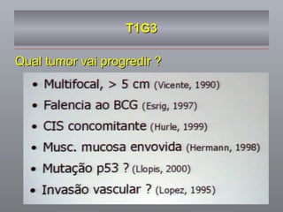 T1G3 Qual tumor vai progredir ? 