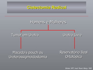Cistectomia Radical Homens e Mulheres Tumor em Uretra Uretra Livre Macedo ’ s pouch ou Ureterossigmoidostomia Reservatório Ileal Ortotópico Bricker: XRT, Insuf. Renal  Março, 1995  