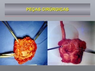 PEÇAS CIRÚRGICAS 