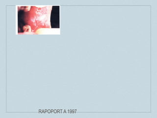 RAPOPORT A 1997
 