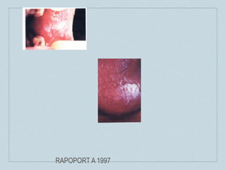 RAPOPORT A 1997
 