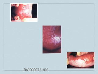 RAPOPORT A 1997
 