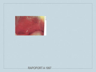 RAPOPORT A 1997
 