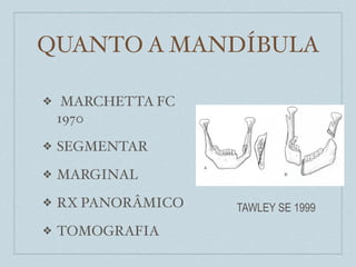 QUANTO A MANDÍBULA

❖    MARCHETTA FC
    1970
❖   SEGMENTAR
❖   MARGINAL
❖   RX PANORÂMICO   TAWLEY SE 1999
❖   TOMOGRAFIA
 