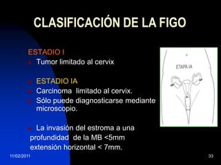 25/11/200924ESTUDIOS DE EXTENSIÓNLinfografía   Evalua metátasis ganglionar.Útil para localizar cadenas iliacas externa, primitiva, paraaórtica.Sensibilidad 79% Especificidad 73%
