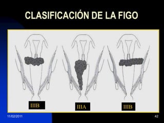  Mesonéfrico25/11/200929CLASIFICACION HISTOLÓGICAOtrosAdenoescamoso 1.7%LinfomasMelanomasSarcomas