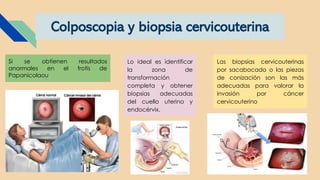 Colposcopia y biopsia cervicouterina
Si se obtienen resultados
anormales en el frotis de
Papanicolaou
Lo ideal es identificar
la zona de
transformación
completa y obtener
biopsias adecuadas
del cuello uterino y
endocérvix.
Las biopsias cervicouterinas
por sacabocado o las piezas
de conización son las más
adecuadas para valorar la
invasión por cáncer
cervicouterino
 