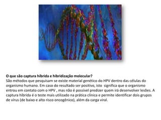 O que são captura híbrida e hibridização molecular? 
São métodos que pesquisam se existe material genético do HPV dentro das células do
organismo humano. Em caso do resultado ser positivo, isto significa que o organismo
entrou em contato com o HPV , mas não é possível predizer quem irá desenvolver lesões. A
captura híbrida é o teste mais utilizado na prática clínica e permite identificar dois grupos
de vírus (de baixo e alto risco oncogênico), além da carga viral.
 