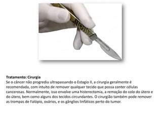 Tratamento: Cirurgia
Se o câncer não progrediu ultrapassando o Estagio II, a cirurgia geralmente é
recomendada, com intuito de remover qualquer tecido que possa conter células
cancerosas. Normalmente, isso envolve uma histerectomia, a remoção do colo do útero e
do útero, bem como alguns dos tecidos circundantes. O cirurgião também pode remover
as trompas de Falópio, ovários, e os gânglios linfáticos perto do tumor.
 