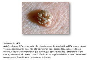 Sintomas do HPV
As infecções por HPV geralmente não têm sintomas. Alguns dos vírus HPV podem causar
verrugas genitais, mas estas não são os mesmos tipos associados ao câncer do colo
uterino. É importante mencionar que as verrugas genitais não irão se transformar em
câncer, mesmo se não forem tratadas. Os tipos cancerigenos de HPV podem permanecer
no organismo durante anos , sem causar sintomas.
 