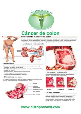 www.distripronavit.com
Cáncer de colon
 
