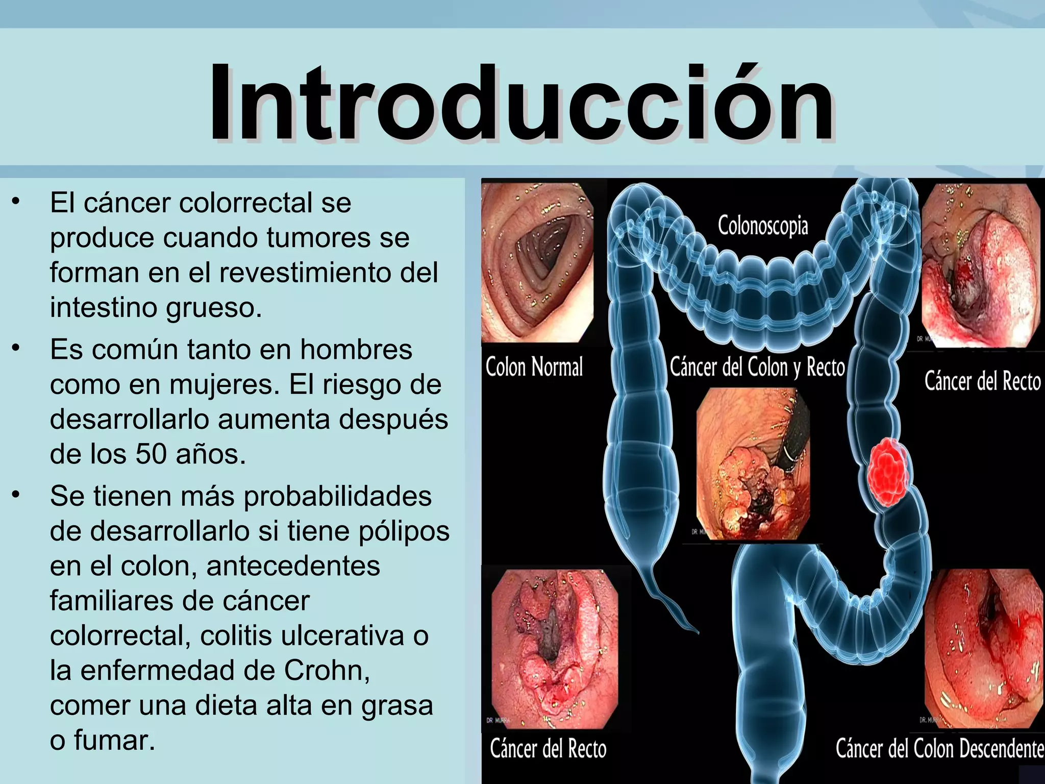 IntroducciónIntroducción
• El cáncer colorrectal se
produce cuando tumores se
forman en el revestimiento del
intestino grueso.
• Es común tanto en hombres
como en mujeres. El riesgo de
desarrollarlo aumenta después
de los 50 años.
• Se tienen más probabilidades
de desarrollarlo si tiene pólipos
en el colon, antecedentes
familiares de cáncer
colorrectal, colitis ulcerativa o
la enfermedad de Crohn,
comer una dieta alta en grasa
o fumar.