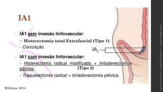 IA1
Histerectomia total Extrafascial (Tipo 1)
(Tipo 2)
Williams, 2014
carolinereisg@gmail.comCâncerdeColouterino–CarolineReisGonçalves
 
