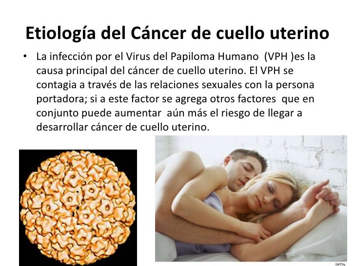 C ncer del cuello uterino (p gina 2)