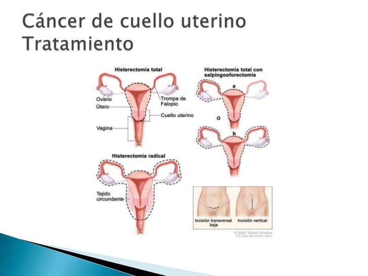Si el tratamiento de las lamblias ha pasado