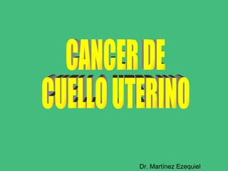 CANCER DE  CUELLO UTERINO Dr. Martínez Ezequiel 