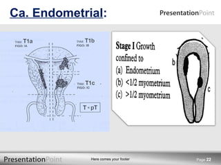 Ca. Endometrial : Page  
