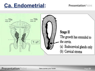 Ca. Endometrial : Page  
