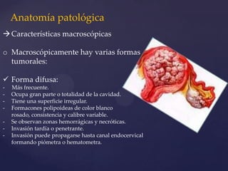 Anatomía patológica
 Características macroscópicas

o Macroscópicamente hay varias formas
tumorales:
 Forma difusa:
-

Más frecuente.
Ocupa gran parte o totalidad de la cavidad.
Tiene una superficie irregular.
Formacones polipoideas de color blanco
rosado, consistencia y calibre variable.
Se observan zonas hemorrágicas y necróticas.
Invasión tardía o penetrante.
Invasión puede propagarse hasta canal endocervical
formando piómetra o hematometra.

 