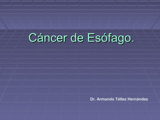 Cáncer de Esófago.



          Dr. Armando Téllez Hernández
 