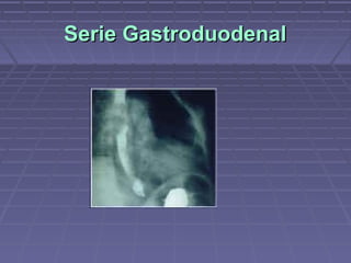 Serie Gastroduodenal
 