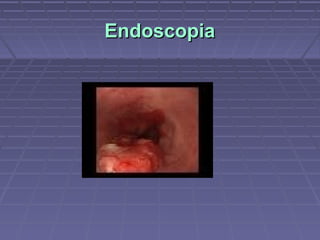 Endoscopia
 