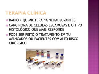  RADIO + QUIMIOTERAPIA NEOADJUVANTES
 CARCINOMA DE CÉLULAS ESCAMOSAS É O TIPO
HISTOLÓGICO QUE MAIS RESPONDE
 PODE SER FEITO O TRATAMENTO EM TU
AVANÇADOS OU PACIENTES COM ALTO RISCO
CIRÚRGICO
 